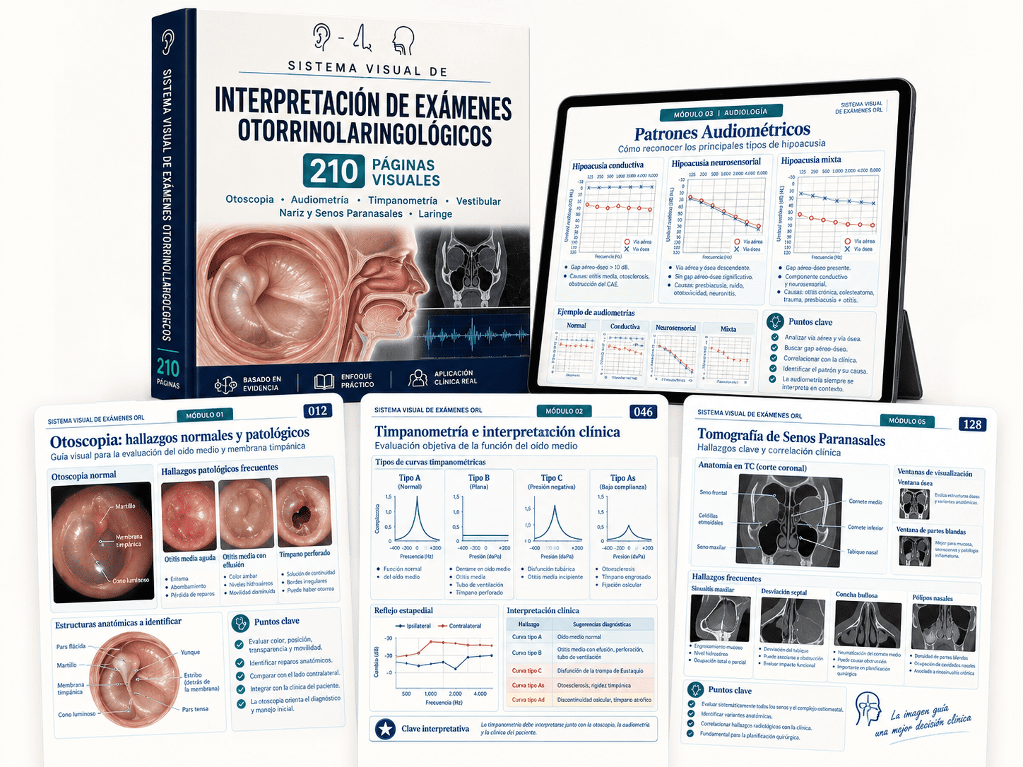 Sistema Esencial de Interpretación Otorrinolaringológica
